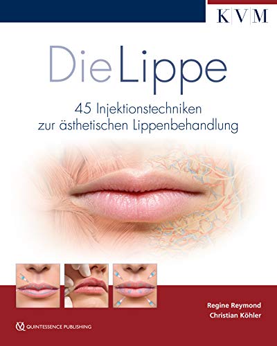 Die Lippe: 45 Injektionstechniken zur...